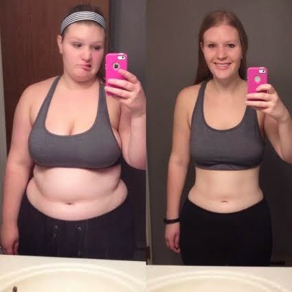 Symbolfoto einer Frau nach erfolgreicher Gewichtsreduktion