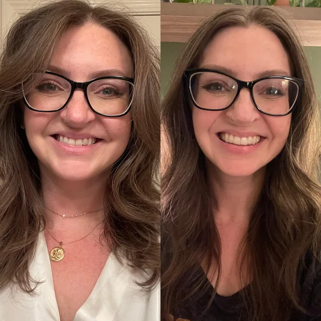 Frau um die 30 mit sichtbar schlankerem Gesicht